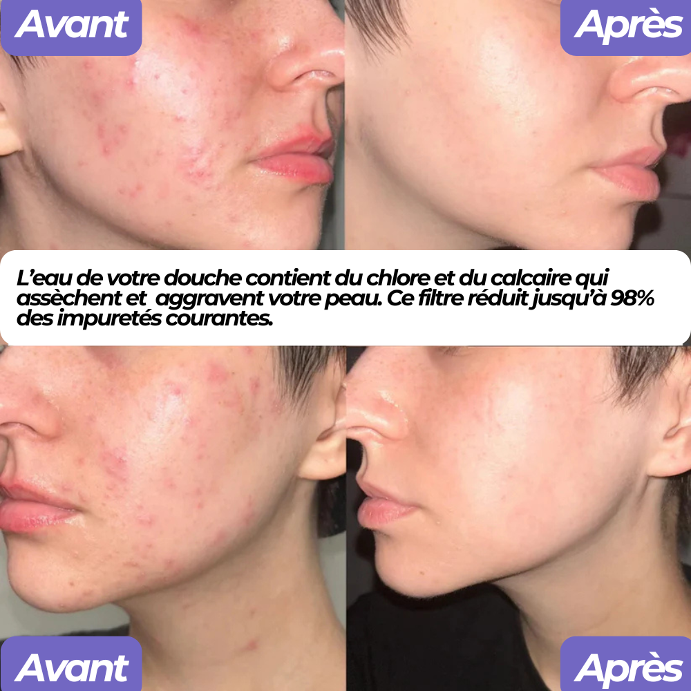 Pomme de douche haute pression filtrante