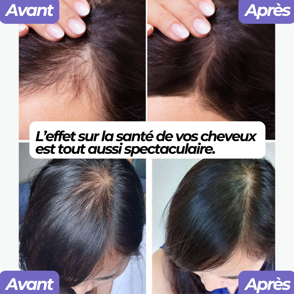 Pomme de douche haute pression filtrante